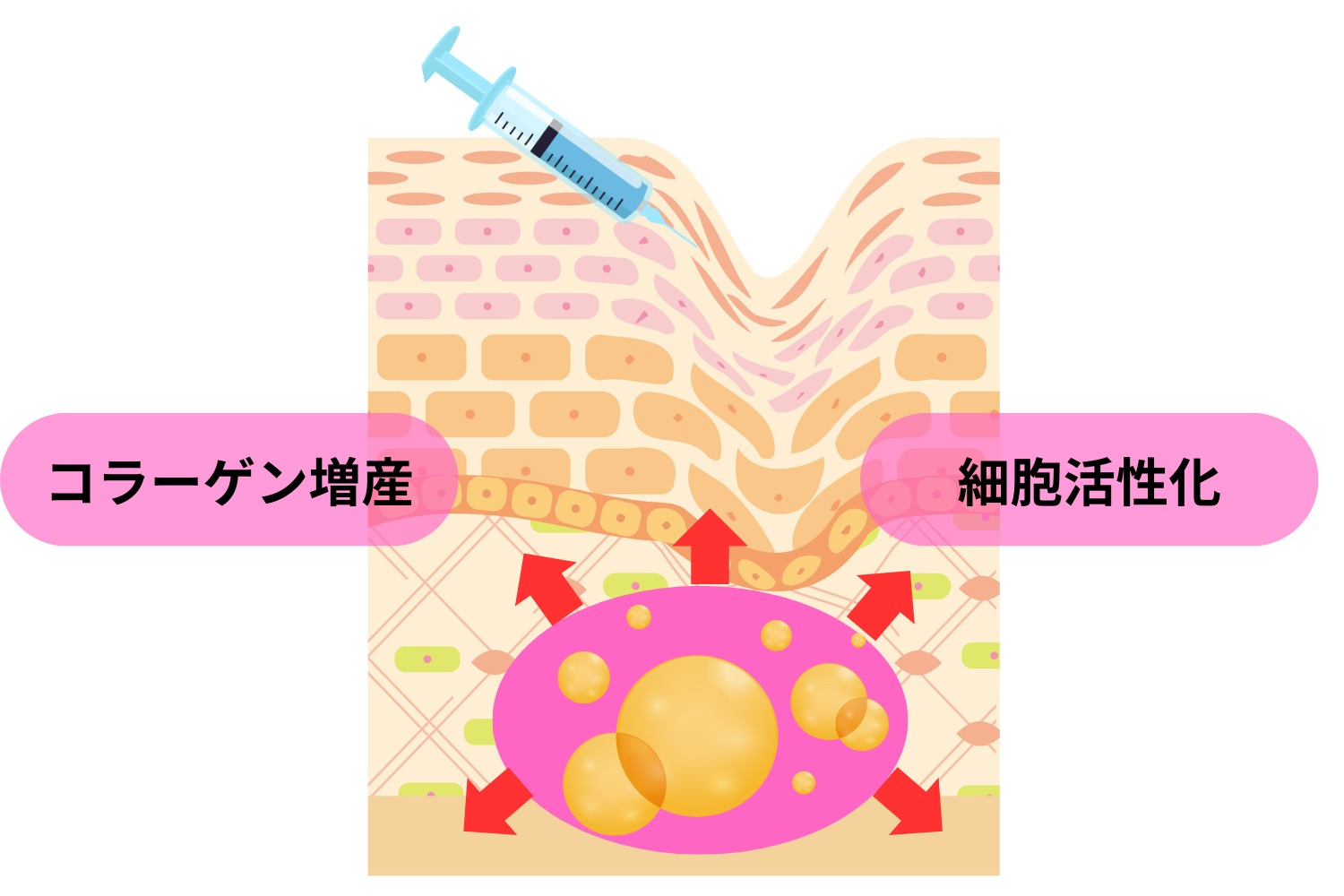 プロファイロのメカニズム