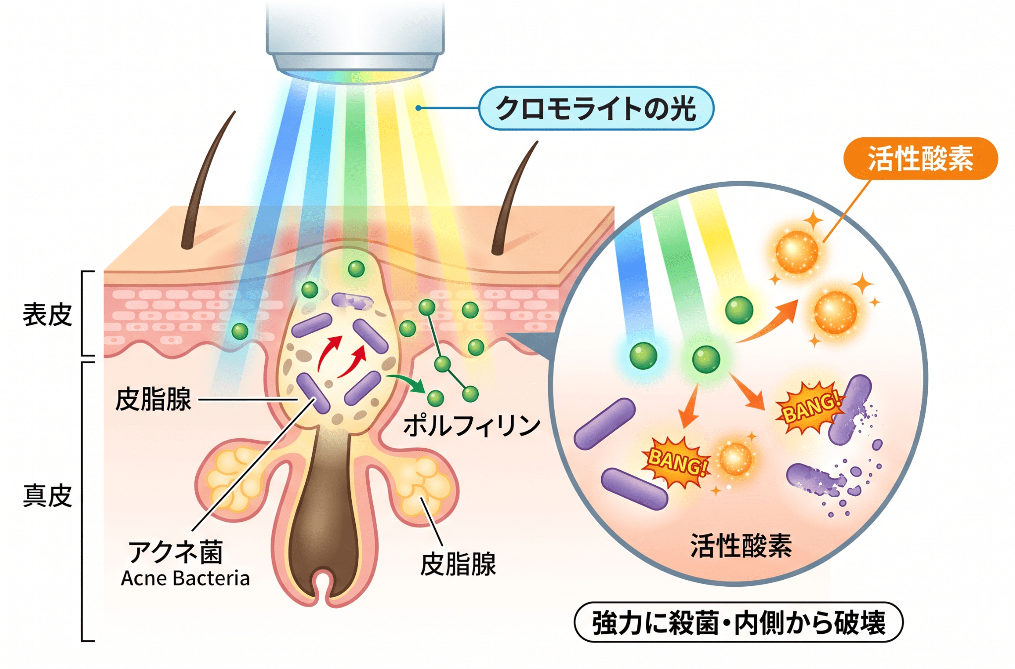 クロモライトがニキビに効果的な理由