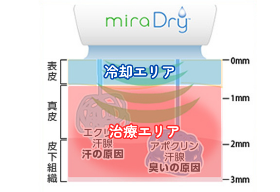 冷却機能で皮膚を守る